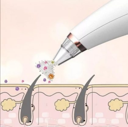 KR_Dermasuction_______