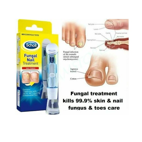 fungush köröm láb kezelése főoldal feltételek gyógyítható-e a körömgomba tabletták nélkül